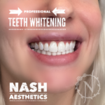 LASER TEETH WHITENING